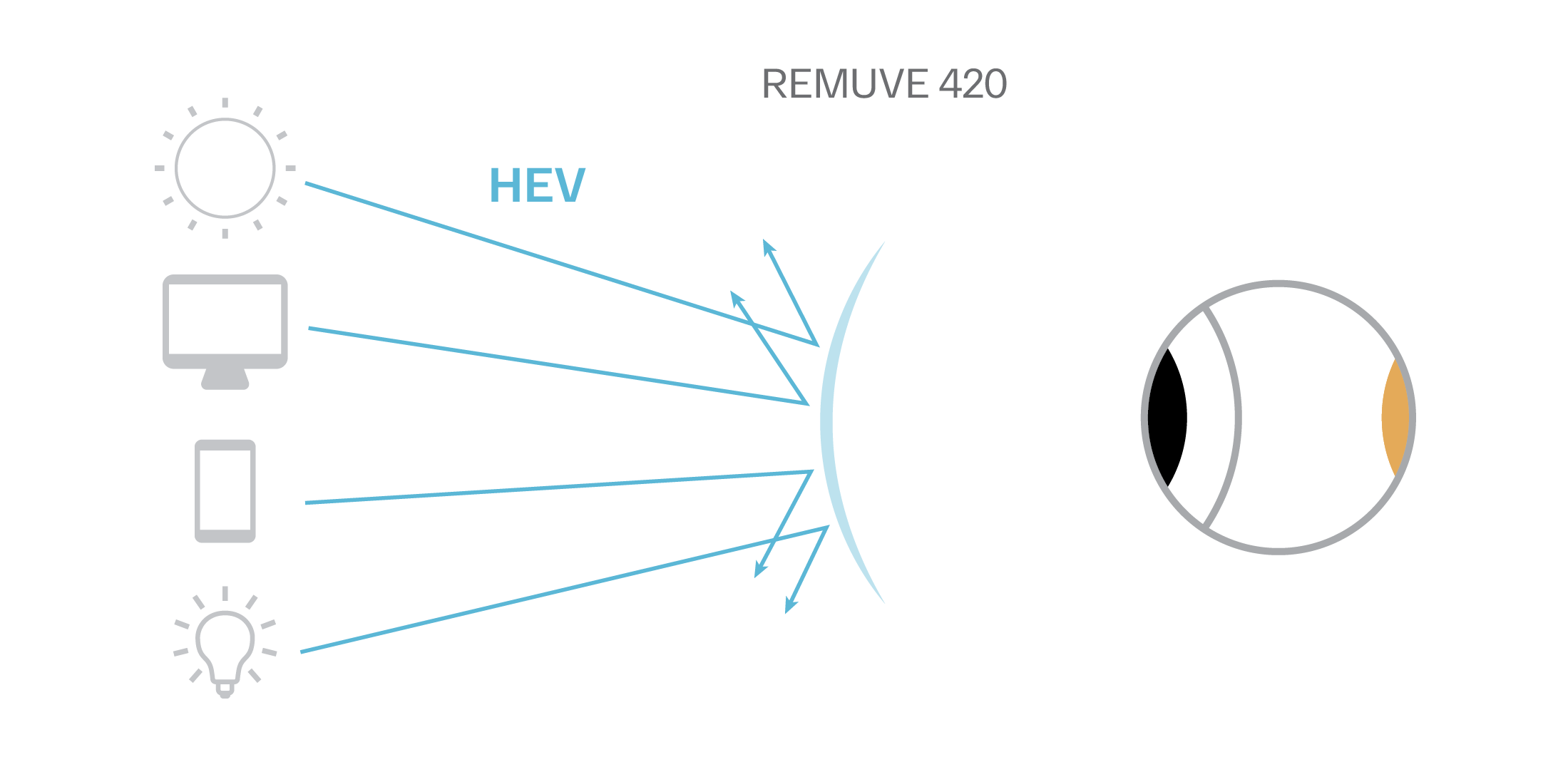 remuve